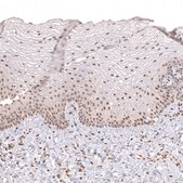 Monoclonal Anti-Prrx1 Antibody Produced In Mouse Prestige Antibodies® Powered by Atlas Antibodies, clone CL14471, affinity isolated antibody, buffered aqueous glycerol solution