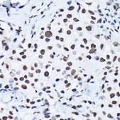 Anti-Phospho-c-Jun-S63 antibody produced in rabbit