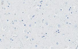 Anti-APP Antibody, clone 1F22 ZooMAb® Rabbit Monoclonal recombinant, expressed in HEK 293 cells