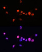Anti-Androgen Receptor antibody produced in rabbit