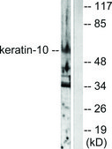 Anti-Keratin 10 antibody produced in rabbit affinity isolated antibody
