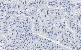 Anti-MDR-1 Antibody, clone 1O12 ZooMAb® Rabbit Monoclonal recombinant, expressed in HEK 293 cells