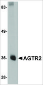 Anti-AGTR2 antibody produced in rabbit affinity isolated antibody, buffered aqueous solution