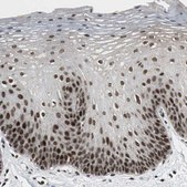 抗-CDK9 兔抗 Prestige Antibodies® Powered by Atlas Antibodies, affinity isolated antibody, buffered aqueous glycerol solution