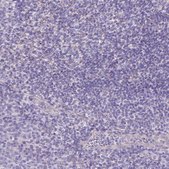 Anti-PNLIP antibody produced in rabbit Prestige Antibodies® Powered by Atlas Antibodies, affinity isolated antibody, buffered aqueous glycerol solution
