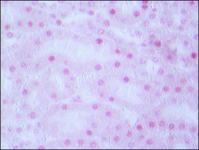 Anti-TDP-43 (C-terminal) antibody produced in rabbit ~1.0 mg/mL, affinity isolated antibody, buffered aqueous solution