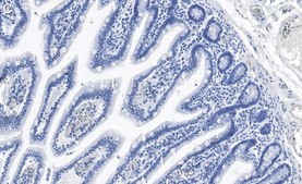 Anti-ErbB-3/HER3 Antibody, clone 1C8 ZooMAb® Rabbit Monoclonal recombinant, expressed in HEK 293 cells