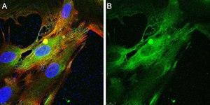 Anti-VEGF Receptor-3 Antibody, clone 9D9F9
