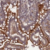 Anti-TMC5 antibody produced in rabbit Prestige Antibodies® Powered by Atlas Antibodies, affinity isolated antibody, buffered aqueous glycerol solution