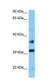 Anti-TNNT1 antibody produced in rabbit affinity isolated antibody