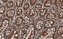 Anti-Calpain-1 Antibody, clone 1H14 ZooMAb® Rabbit Monoclonal recombinant, expressed in HEK 293 cells