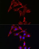 Anti- STAT3 antibody produced in rabbit