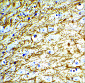 Anti-Clusterin antibody produced in rabbit affinity isolated antibody, buffered aqueous solution