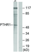 Anti-PTHR1 antibody produced in rabbit affinity isolated antibody