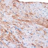 Anti-α-Actin-1 (ATCA1) antibody produced in rabbit