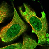 Anti-PRKD3 antibody produced in rabbit Prestige Antibodies® Powered by Atlas Antibodies, affinity isolated antibody, buffered aqueous glycerol solution