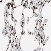 Anti-CD74 antibody produced in rabbit Prestige Antibodies® Powered by Atlas Antibodies, affinity isolated antibody, buffered aqueous glycerol solution