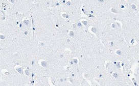 Anti-Reelin Antibody, clone 3F13 ZooMAb® Rabbit Monoclonal recombinant, expressed in HEK 293 cells