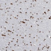 Anti-TOP2B antibody produced in rabbit Prestige Antibodies® Powered by Atlas Antibodies, affinity isolated antibody, buffered aqueous glycerol solution