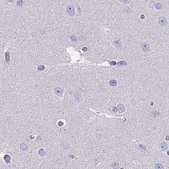 Anti-CYP51A1 antibody produced in rabbit Prestige Antibodies® Powered by Atlas Antibodies, affinity isolated antibody, buffered aqueous glycerol solution