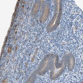 Anti-DYRK1A antibody produced in rabbit Prestige Antibodies® Powered by Atlas Antibodies, affinity isolated antibody, buffered aqueous glycerol solution