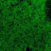 Monoclonal Anti-GAD2 antibody produced in mouse Prestige Antibodies® Powered by Atlas Antibodies, clone CL2736, purified immunoglobulin, buffered aqueous glycerol solution