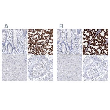 Anti-CSN3 antibody produced in rabbit Prestige Antibodies® Powered by Atlas Antibodies, affinity isolated antibody