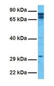 Anti-PARP2 affinity isolated antibody