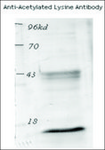 抗-乙酰化赖氨酸 兔抗 1 mg/mL, affinity isolated antibody