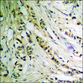 Anti-phospho-p27 Kip1 (pThr198) antibody produced in rabbit affinity isolated antibody