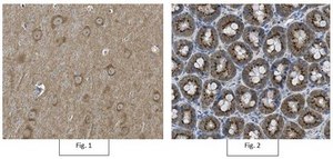 抗代谢型谷氨酸受体5抗体，疼痛 Chemicon®, from rabbit