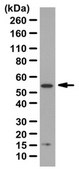 Anti-CCN1/CYR61 Antibody from rabbit, purified by affinity chromatography