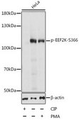 Anti-Phospho-EEF2K-S366 antibody produced in rabbit