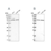 抗-P2RX7 兔抗 Prestige Antibodies® Powered by Atlas Antibodies, affinity isolated antibody, buffered aqueous glycerol solution