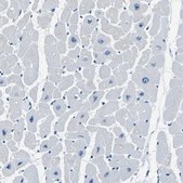 Anti-PHKG1 antibody produced in rabbit Prestige Antibodies® Powered by Atlas Antibodies, affinity isolated antibody, buffered aqueous glycerol solution