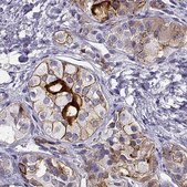 Anti-IGSF1 antibody produced in rabbit Prestige Antibodies® Powered by Atlas Antibodies, affinity isolated antibody, buffered aqueous glycerol solution