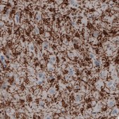 Monoclonal Anti-MBP antibody produced in mouse Prestige Antibodies® Powered by Atlas Antibodies, clone CL2829, purified immunoglobulin, buffered aqueous glycerol solution