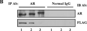 Anti-Androgen Receptor Antibody from rabbit, purified by affinity chromatography