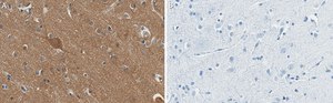 Anti-Substance P Antibody, clone 1K3 ZooMAb® Rabbit Monoclonal recombinant, expressed in HEK 293 cells