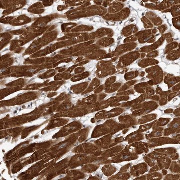 Anti-ABL1 antibody produced in rabbit Prestige Antibodies® Powered by Atlas Antibodies, affinity isolated antibody, buffered aqueous glycerol solution, Ab1