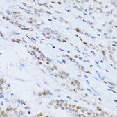 Anti-P21 antibody produced in rabbit