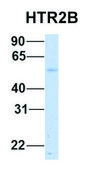 Anti-HTR2B (N-terminal) antibody produced in rabbit affinity isolated antibody