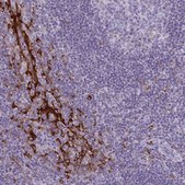 Anti-CARD9 antibody produced in rabbit Prestige Antibodies® Powered by Atlas Antibodies, affinity isolated antibody, buffered aqueous glycerol solution