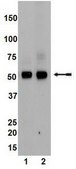 Anti-PTEN Antibody, clone 6H2.1 clone 6H2.1, Upstate®, from mouse