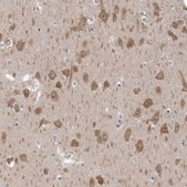 Anti-GSK3B antibody produced in rabbit affinity isolated antibody, buffered aqueous glycerol solution