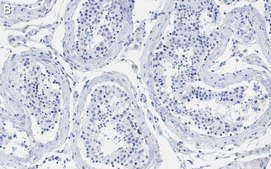 Anti-MGMT Antibody, clone 2N19 ZooMAb® Rabbit Monoclonal recombinant, expressed in HEK 293 cells