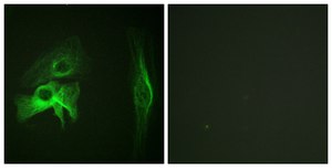 Anti-PAK1 antibody produced in rabbit affinity isolated antibody