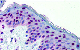 Anti-FOSL1 affinity isolated antibody