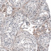 Anti-CHRM3 antibody produced in rabbit Prestige Antibodies® Powered by Atlas Antibodies, affinity isolated antibody, buffered aqueous glycerol solution