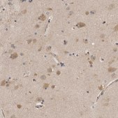 Anti-PSMB2 antibody produced in rabbit Prestige Antibodies® Powered by Atlas Antibodies, affinity isolated antibody, buffered aqueous glycerol solution, Ab1